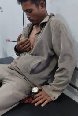 BREAKING NEWS: BRUTAL! Dua Warga Luat Unterudang Tertembak Panah, Diserang Oknum Preman Berkedok Sekuriti PT Barapala Setelah Polisi Pergi